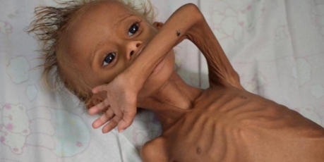 Canada & Spain: Release urgent aid to Yemen’s people