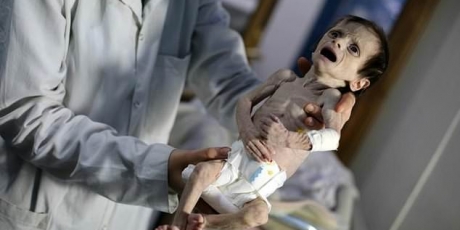 Save Ghouta's Starving Children