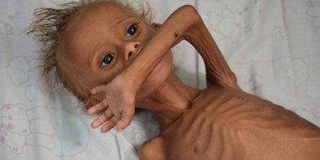 US Senate: End the Yemen catastrophe