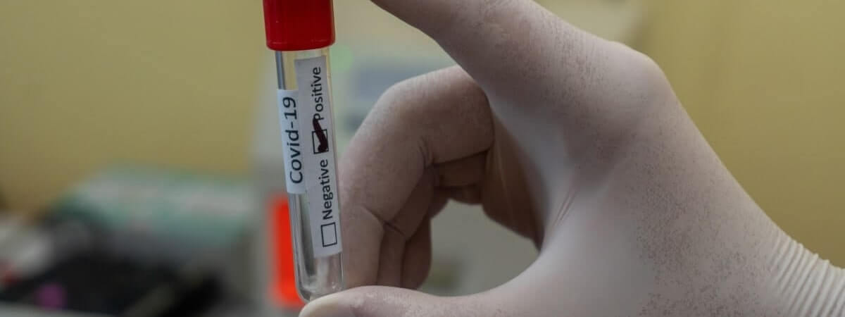 1 em cada 4 brasileiros pode não se vacinar contra a COVID-19